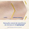 4006000045320-NIVEA_LUMINOUS_630_S_rum_leo_Corporal_Antiestrias_100ml-Body__Hand-NIVEA--5-.jpg