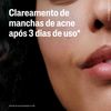 746993-serum-cetaphil-oil-control-30ml-tripla-acao-4